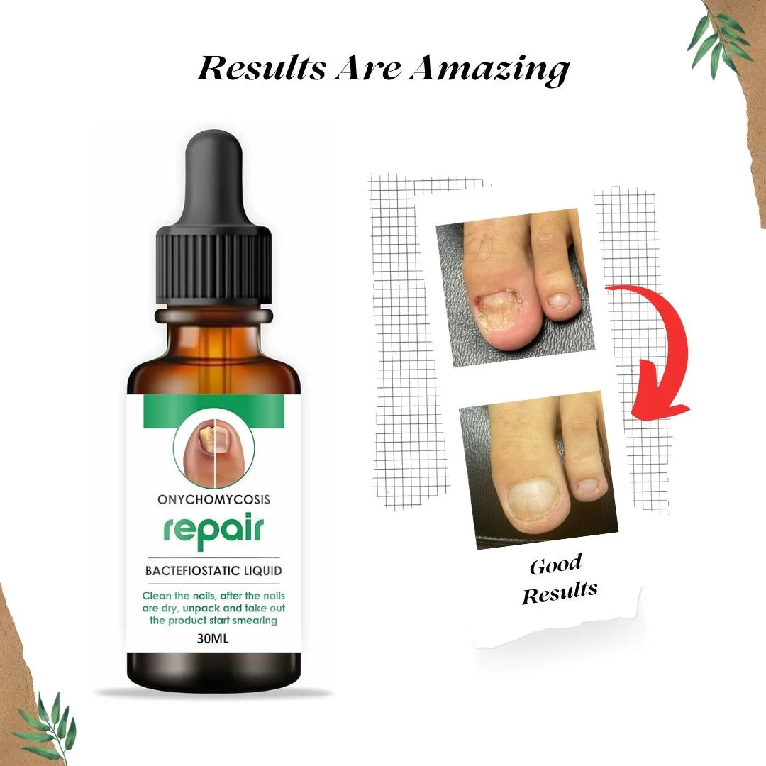 Nail Repair Serum (📢Buy 1 Get 1 FREE) MAN & WOMAN