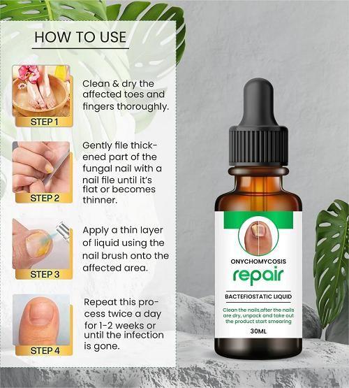Nail Repair Serum (📢Buy 1 Get 1 FREE) MAN & WOMAN