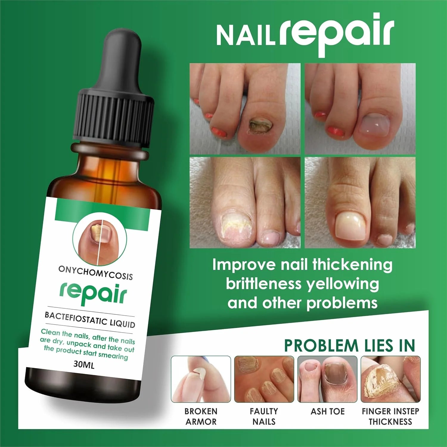 Nail Repair Serum (📢Buy 1 Get 1 FREE) MAN & WOMAN
