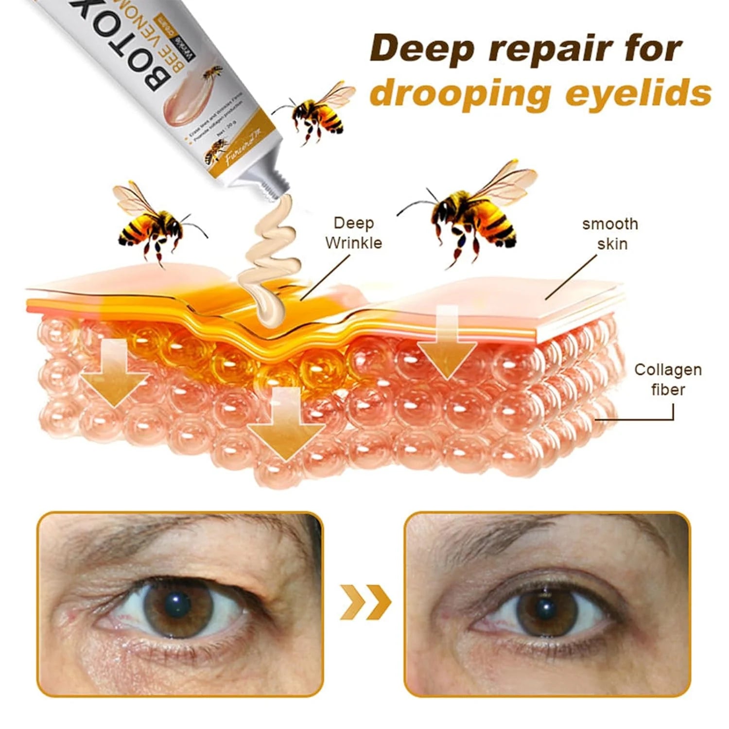 BeeTox™ - Bee Venom Wrinkle Repair Cream 🐝✨ (Buy 1 Get 1 Free 🔥🔥)